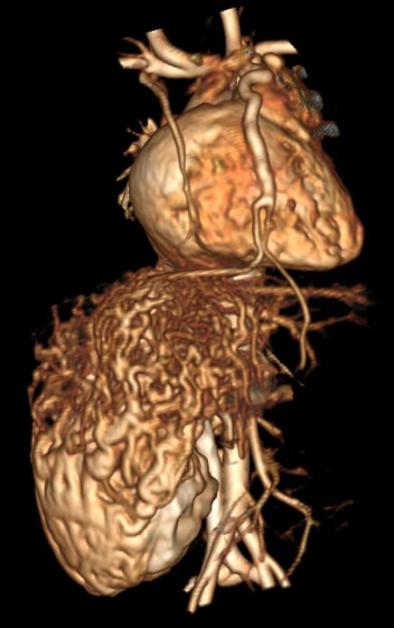 Advanced Imaging